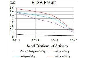 Black line: Control Antigen (100 ng), Purple line: Antigen(10 ng), Blue line: Antigen (50 ng), Red line: Antigen (100 ng), (Intestinal Alkaline Phosphatase anticorps  (AA 397-458))