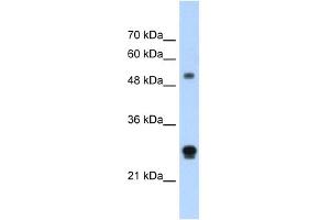 WB Suggested Anti-IGSF1 Antibody Titration:  1. (IGSF1 anticorps  (N-Term))