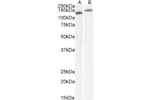 ABIN1781839 (1µg/ml) staining of Mouse (A) and Rat (B) Brain lysate (35µg protein in RIPA buffer).