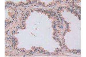 Figure. (LOXL2 anticorps  (AA 544-751))