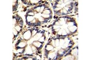 TNFR antibody immunohistochemistry analysis in formalin fixed and paraffin embedded human rectum tissue.