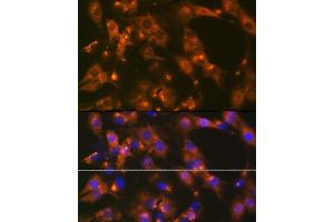 Immunofluorescence analysis of C6 cells using  Rabbit mAb (ABIN1681069, ABIN3018897, ABIN3018898 and ABIN7101684) at dilution of 1:100 (40x lens).
