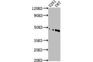 Western Blot Positive WB detected in: U251 whole cell lysate, U87 whole cell lysate All lanes: OTUD3 antibody at 1:1000 Secondary Goat polyclonal to rabbit IgG at 1/50000 dilution Predicted band size: 46 kDa Observed band size: 46 kDa (OTUD3 anticorps  (AA 108-398))
