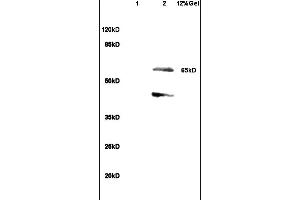 Lane 1: rat heart lysates Lane 2: rat brain lysates probed with Anti SHC3 Polyclonal Antibody, Unconjugated (ABIN715661) at 1:200 in 4 °C. (SHC3 anticorps  (AA 501-594))
