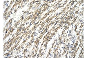 Rabbit Anti-HIF1A antibody   Paraffin Embedded Tissue: Human Heart cell Cellular Data: cardiac cell of renal tubule Antibody Concentration: 4.