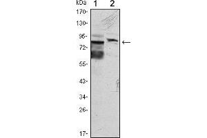 Western blot analysis using KLHL11 mouse mAb against Hela (1) and MCF-7 (2) cell lysate. (KLHL11 anticorps)