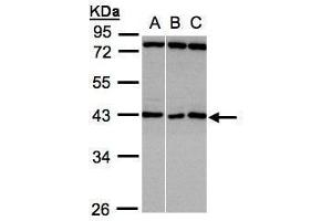 WB Image Sample(30 ug whole cell lysate) A:A431, B:HeLa S3, C:Hep G2 , 10% SDS PAGE antibody diluted at 1:1000 (ASB5 anticorps)
