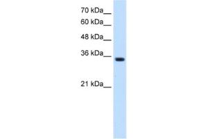 Western Blotting (WB) image for anti-Transient Receptor Potential Cation Channel, Subfamily M, Member 5 (TRPM5) antibody (ABIN2461116) (TRPM5 anticorps)