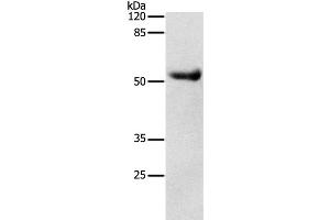 Western Blot analysis of Human liver cancer tissue using DRD4 Polyclonal Antibody at dilution of 1:600 (DRD4 anticorps)