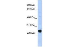 Image no. 1 for anti-Chromosome 16 Open Reading Frame 80 (C16orf80) (AA 71-120) antibody (ABIN6740375) (C16orf80 anticorps  (AA 71-120))
