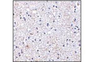 Immunohistochemistry of SCO1 in human brain tissue with this product at 2. (SCO1 anticorps  (Center))