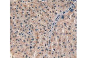 IHC-P analysis of Human Liver Tissue, with DAB staining. (CHI3L1 anticorps  (AA 112-377))
