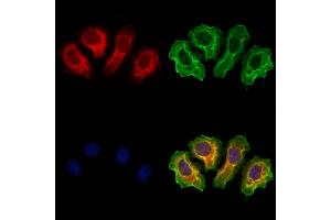 ABIN6264770 and ABIN6273310 staining Hela cells by IF/ICC.