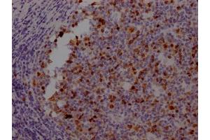 IHC image of ABIN7127357 diluted at 1:100 and staining in paraffin-embedded human tonsil tissue performed on a Leica BondTM system. (Recombinant Aurora Kinase B anticorps)