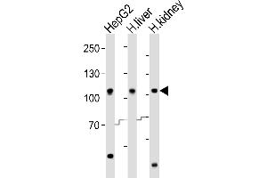Western blot analysis of lysates from HepG2 cell line, human liver, human kidney tissue (from left to right), using MTTP Antibody (C-term) (ABIN6242904 and ABIN6577849). (MTTP anticorps  (C-Term))