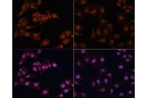 Immunofluorescence analysis of HeLa cells using MAP1LC3B antibody (ABIN6291773) at dilution of 1:100. (LC3B anticorps)