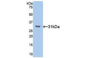 Western blot analysis of recombinant Human RORa. (RORA anticorps  (AA 164-401))