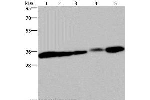 Western Blot analysis of HUVEC and 293T cell, Mouse bladder, Human placenta and Mouse kidney tissue using Claudin 23 Polyclonal Antibody at dilution of 1:200 (Claudin 23 anticorps)