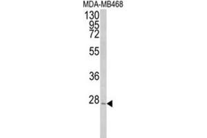 Western Blotting (WB) image for anti-Peroxisomal Biogenesis Factor 11 alpha (PEX11A) antibody (ABIN3004001)