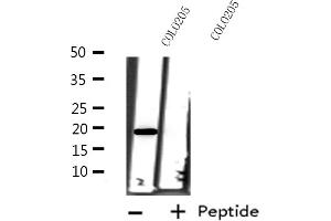Western blot analysis of extracts from COLO205 cells, using ARF6 antibody. (ARF6 anticorps  (Internal Region))