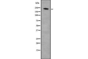 Western blot analysis of ARHGEF17 using K562 whole cell lysates (ARHGEF17 anticorps  (C-Term))