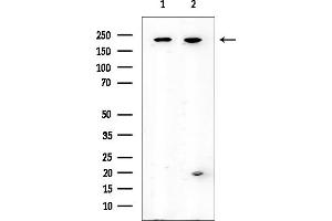 anti-Eukaryotic Translation Initiation Factor 4 Gamma, 1 (EIF4G1) (Internal Region) antibody