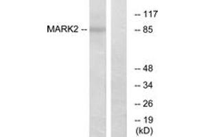 Western blot analysis of extracts from COS7 cells, using MARK2 Antibody. (MARK2 anticorps  (AA 10-59))
