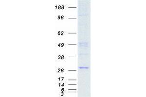 Validation with Western Blot