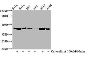 Western Blot Positive WB detected in Hela whole cell lysate,293 whole cell lysate,A549 whole cell lysate(treated with Calyculin A or not) All lanes Phospho-GSK3B antibody at 0. (Recombinant GSK3 beta anticorps  (pSer9))