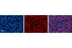 ASAHL antibody - middle region          Formalin Fixed Paraffin Embedded Tissue:  Human Liver Tissue    Observed Staining:  Cytoplasm in lysosomes of hepatocytes   Primary Antibody Concentration:  1:100    Other Working Concentrations:  1/600    Secondary Antibody:  Donkey anti-Rabbit-Cy3    Secondary Antibody Concentration:  1:200    Magnification:  20X    Exposure Time:  0.