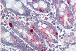 Human Small Intestine (formalin-fixed, paraffin-embedded) stained with MED4 antibody ABIN462248 followed by biotinylated goat anti-rabbit IgG secondary antibody ABIN481713, alkaline phosphatase-streptavidin and chromogen.