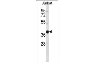 RCH4 Antibody (C-term) (ABIN657255 and ABIN2846352) western blot analysis in Jurkat cell line lysates (35 μg/lane). (MARCH4 anticorps  (C-Term))
