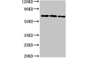 Western Blot Positive WB detected in: 293T whole cell lysate, Hela whole cell lysate, HepG2 whole cell lysate All lanes: NTN1 antibody at 6. (Netrin 1 anticorps  (AA 186-478))