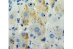 IHC-P analysis of Liver tissue, with DAB staining. (IL18RAP anticorps  (AA 117-240))