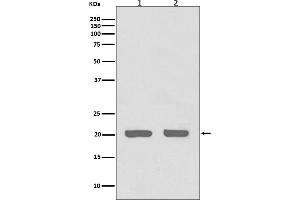 Western blot analysis of IL1RA expression in (1) HeLa cell lysate, (2) 3T3 cell lysate.