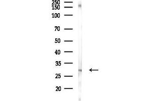 anti-Carbonic Anhydrase III (CA3) (N-Term) antibody
