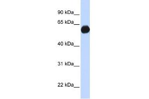 AKAP1 antibody used at 1 ug/ml to detect target protein. (AKAP1 anticorps)
