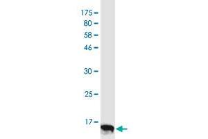 Western Blot detection against Immunogen (11.