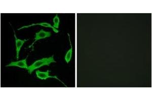 Immunofluorescence analysis of LOVO cells, using GPR85 Antibody. (GPR85 anticorps  (AA 181-230))