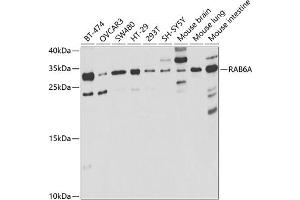 Western blot analysis of extracts of various cell lines, using RA antibody (ABIN6128604, ABIN6146602, ABIN6146604 and ABIN6221246) at 1:1000 dilution.