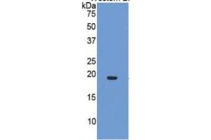 WB of Protein Standard: different control antibodies  against Highly purified E. (IL-17 Kit ELISA)