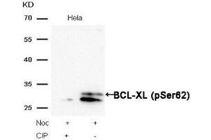 Western blot analysis of extracts from Hela cells, treated with Noc or calf intestinal phosphatase (CIP), using BCL-XL (Phospho-Ser62) Antibody.