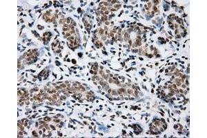Immunohistochemical staining of paraffin-embedded breast tissue using anti-SHC1 mouse monoclonal antibody. (SHC1 anticorps)