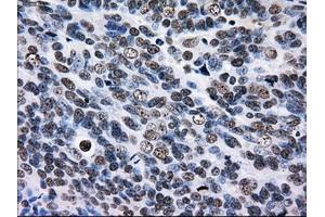 Immunohistochemical staining of paraffin-embedded Kidney tissue using anti-RPA2 mouse monoclonal antibody. (RPA2 anticorps)
