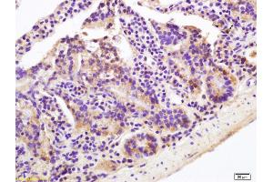 Formalin-fixed and paraffin embedded mouse intestine labeled with Rabbit Anti OAT-3 Polyclonal Antibody, Unconjugated (ABIN670821) at 1:200 followed by conjugation to the secondary antibody and DAB staining