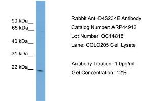 WB Suggested Anti-D4S234E  Antibody Titration: 0. (NSG1 anticorps  (N-Term))