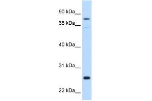 WB Suggested Anti-GSTM2 Antibody Titration:  0. (GSTM2 anticorps  (N-Term))