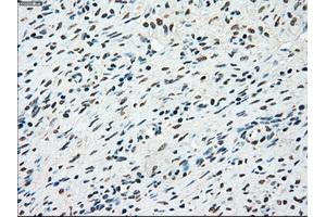 Immunohistochemical staining of paraffin-embedded colon tissue using anti-STK3mouse monoclonal antibody. (STK3 anticorps)