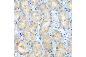 Immunohistochemistry of paraffin-embedded Rat kidney using C9orf114 Rabbit pAb (ABIN7266390) at dilution of 1:100 (40x lens). (C9orf114 anticorps)