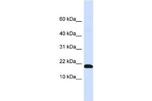WB Suggested Anti-DNAJC25-GNG10 Antibody Titration:  0. (DNAJC25-GNG10 anticorps  (N-Term))